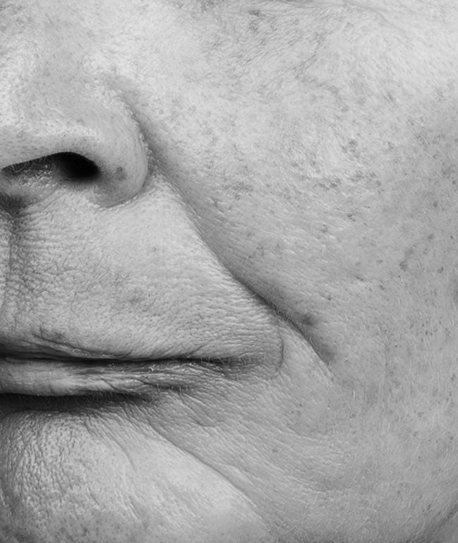 DULL COMPLEXION