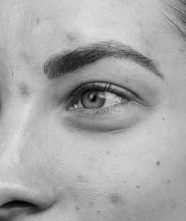 YOUNG SKIN
