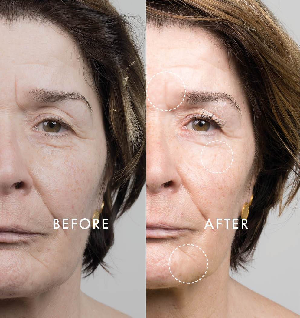 Side-by-side before and after comparison of a mature woman’s face showing reduced wrinkles, smoother skin texture, and improved brightness after skincare treatment.