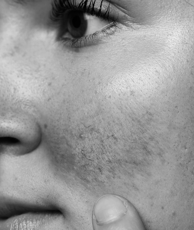 Sensitive Skin
